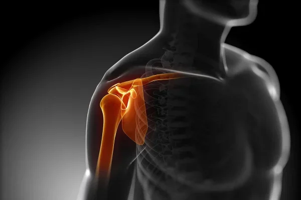 دررفتگی شانه